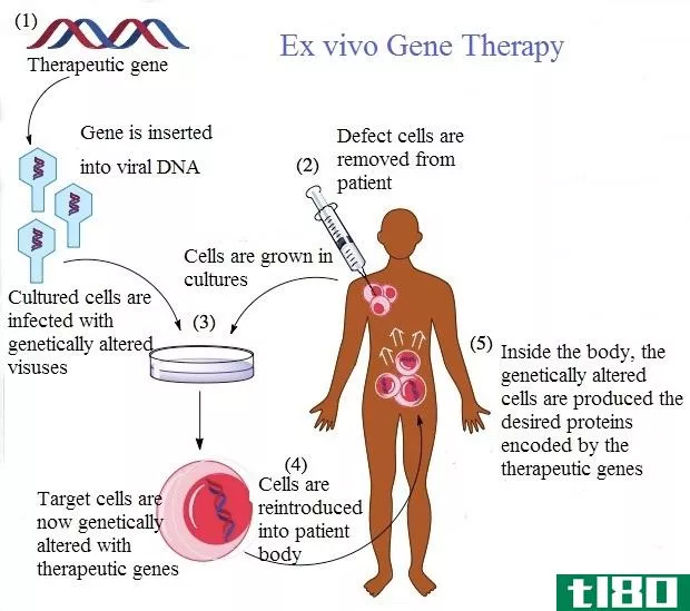 离体(ex vivo)和体内基因治疗(in vivo gene therapy)的区别