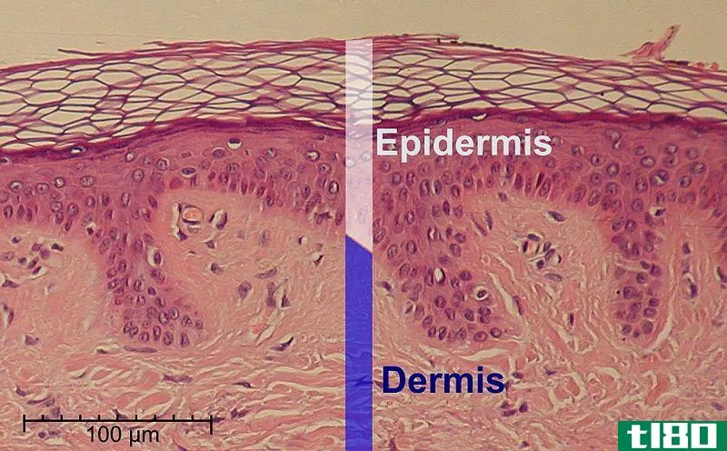 表皮(epidermis)和真皮(dermis)的区别