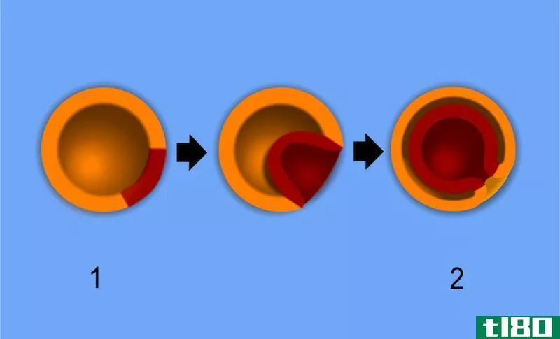 二倍体(diploblastic)和三胚层(triploblastic)的区别