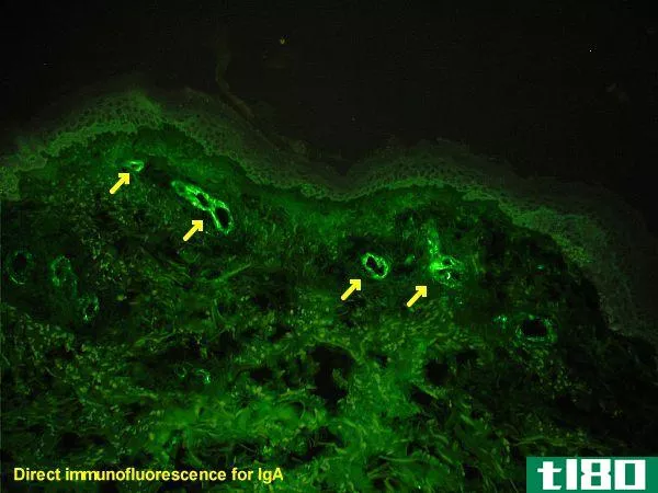 直接的(direct)和间接免疫荧光(indirect immunofluorescence)的区别