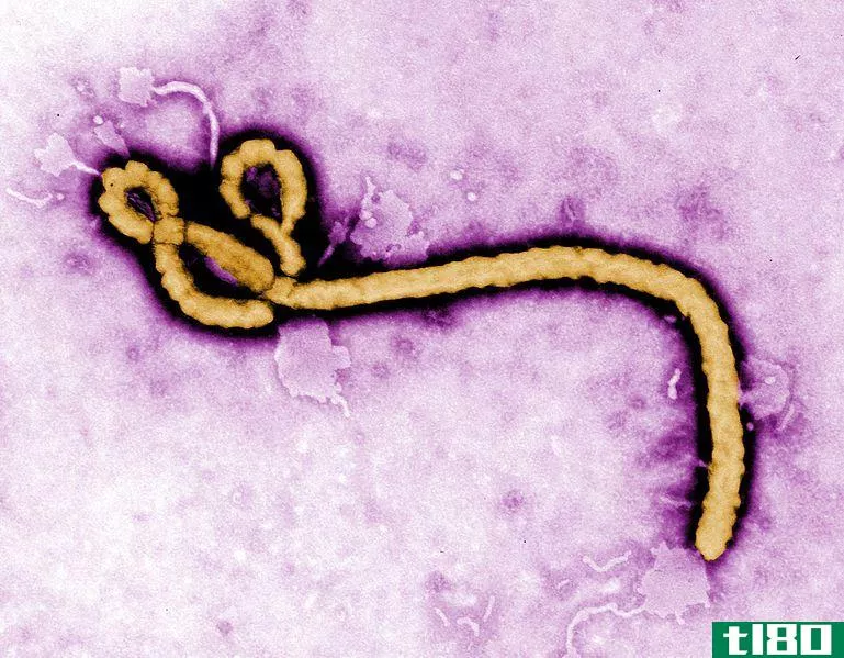 埃博拉病毒(ebola)和马尔堡(marburg)的区别