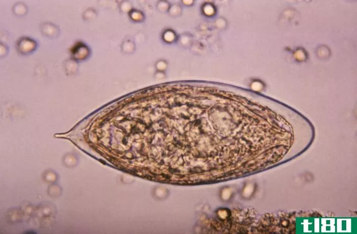 曼氏血吸虫(schistosoma mansoni)和血杆菌(haemotobium)的区别