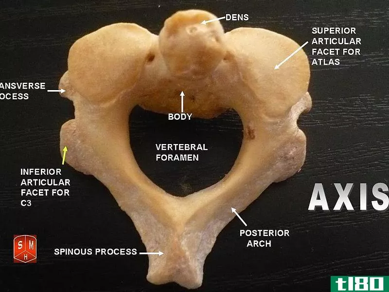 典型的(typical)和非典型脊椎(atypical vertebrae)的区别