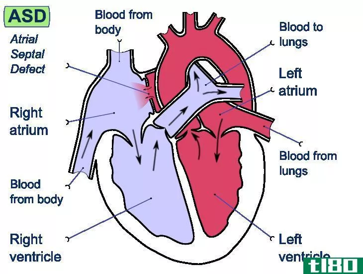 左边(left)和心脏右侧(right side of heart)的区别