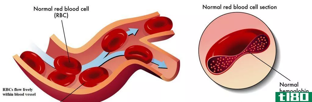 正常血红蛋白(normal hemoglobin)和镰状细胞血红蛋白(sickle cell hemoglobin)的区别