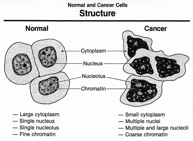 癌细胞(cancer cells)和正常细胞(normal cells)的区别