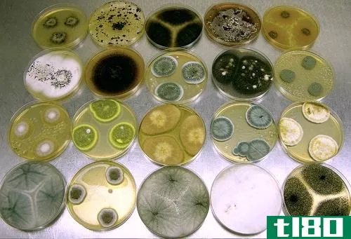 细菌性(bacterial)和真菌菌落(fungal colonies)的区别