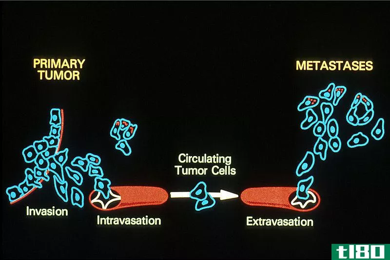 入侵(invasion)和转移(metastasis)的区别