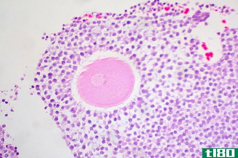 次级卵母细胞(secondary oocyte)和卵子(ovum)的区别