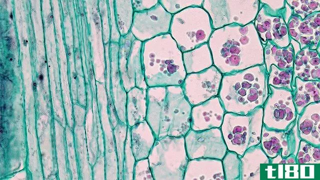 薄壁组织(parenchyma)和间充质细胞(mesenchymal cells)的区别
