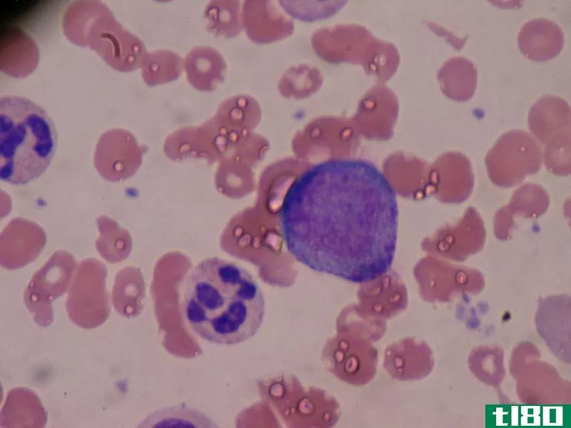 早幼粒细胞(promyelocyte)和骨髓细胞(myelocyte)的区别