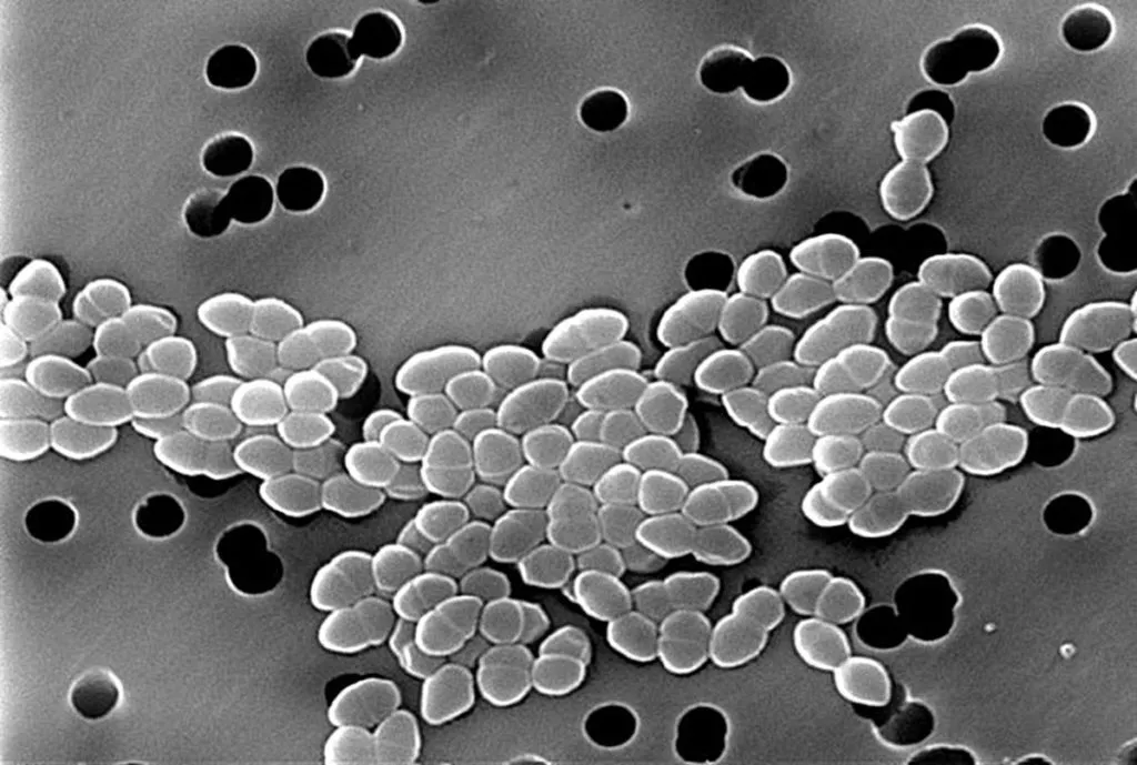 肠球菌(enterococcus)和链球菌(streptococcus)的区别