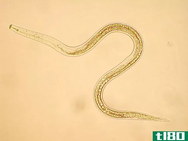 扁形动物(platyhelminthes)和蛔虫(aschelminthes)的区别