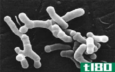 乳酸菌(lactobacillus)和双歧杆菌(bifidobacterium)的区别