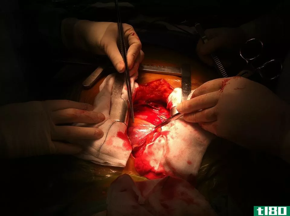 三重旁路(triple bypass)和心脏直视手术(open heart surgery)的区别