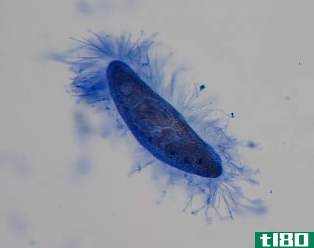 变形虫(amoeba)和草履虫(paramecium)的区别