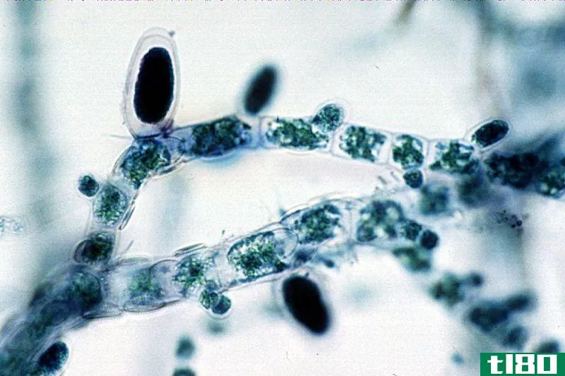 单目(unilocular)和多球孢子囊(plurilocular sporangia)的区别