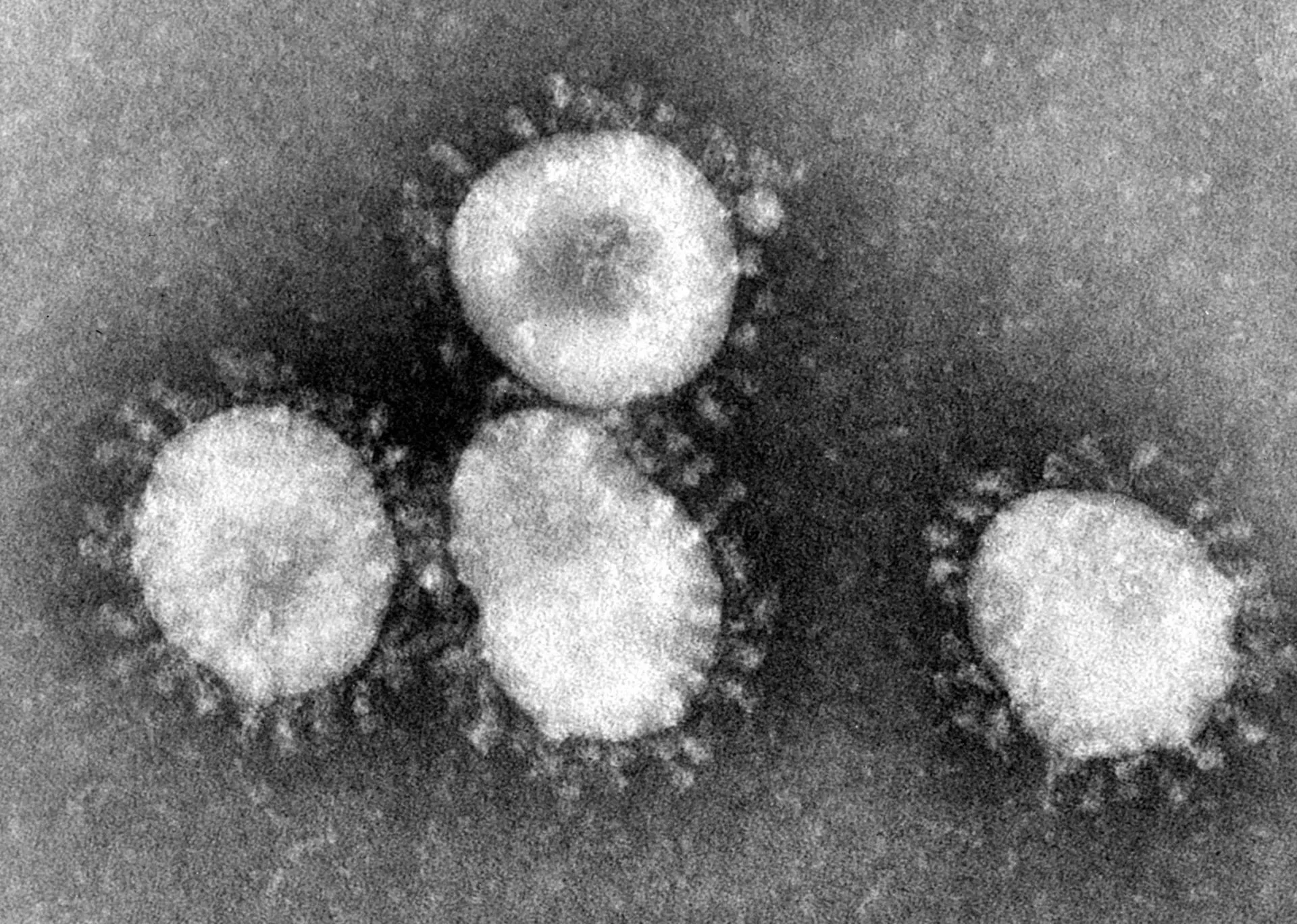 冠状病毒(coronavirus)和鼻病毒(rhinovirus)的区别