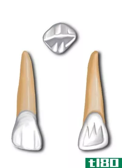 上颌中央(maxillary central)和侧切牙(lateral incisor)的区别