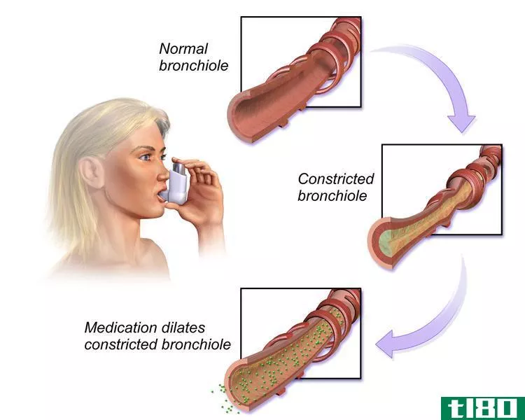 支气管痉挛(bronchospa**s)和喉痉挛(laryngospa**s)的区别