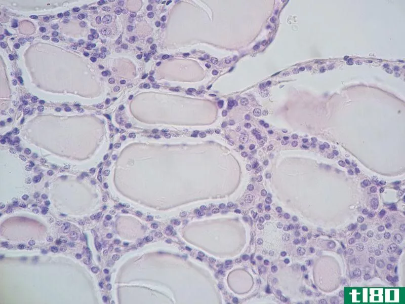 卵泡旁(parafollicular)和滤泡细胞(follicular cells)的区别