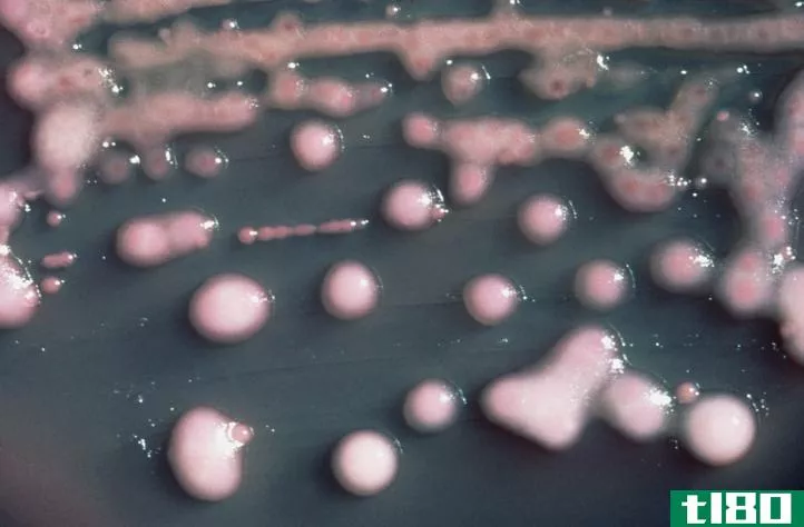肺炎克雷伯菌(klebsiella pneumoniae)和肺炎链球菌(streptococcus pneumoniae)的区别
