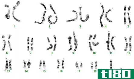 **的(male)和**核型(female karyotypes)的区别