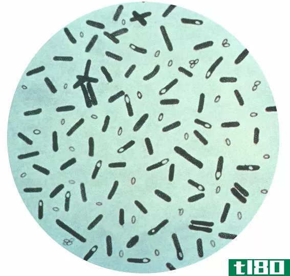 芽孢杆菌(bacillus)和梭菌(clostridium)的区别