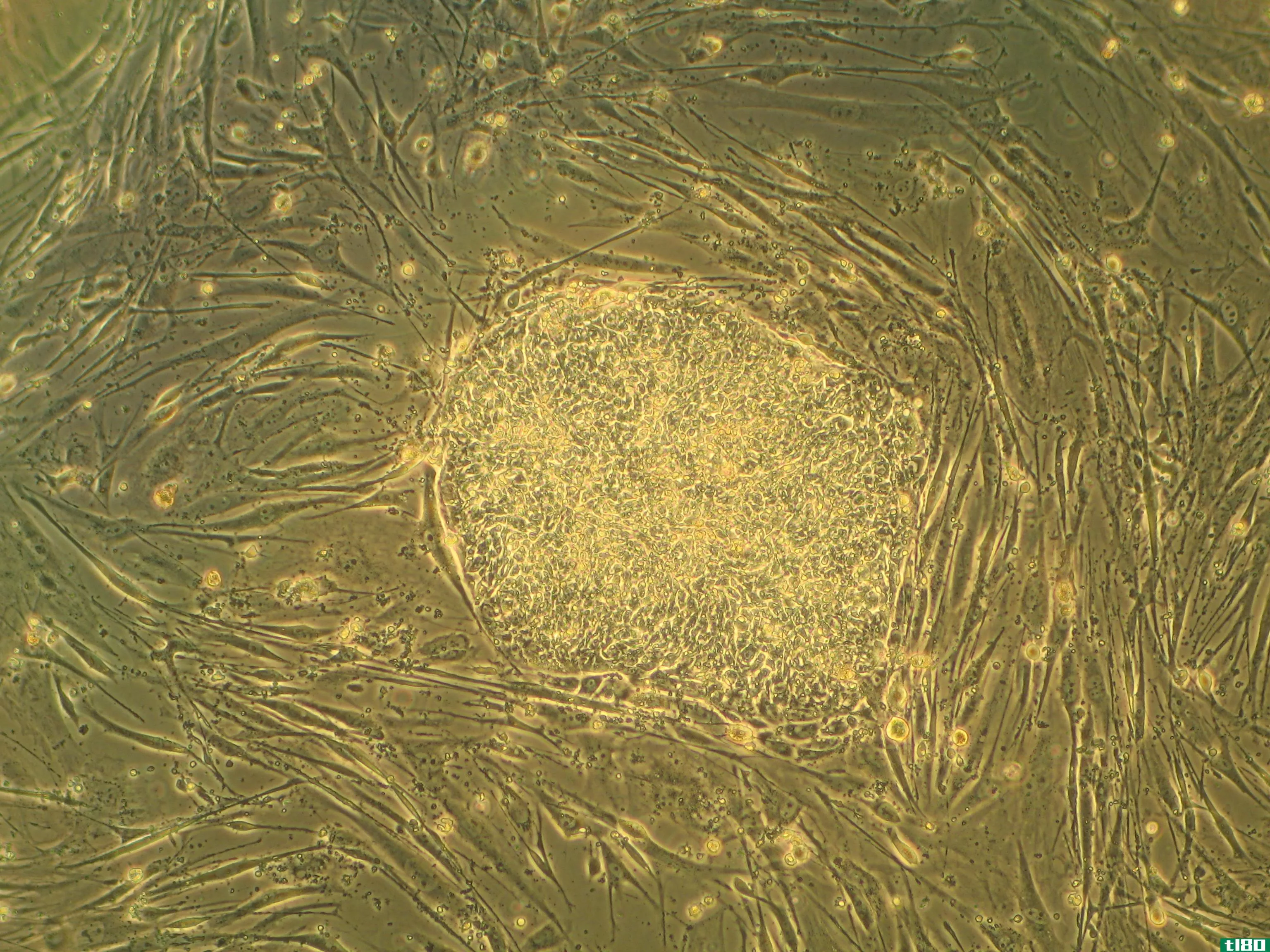 胎儿(fetal)和胚胎干细胞(embryonic stem cells)的区别