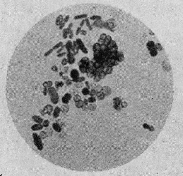 固氮菌(azotobacter)和偶氮螺菌(azospirillum)的区别