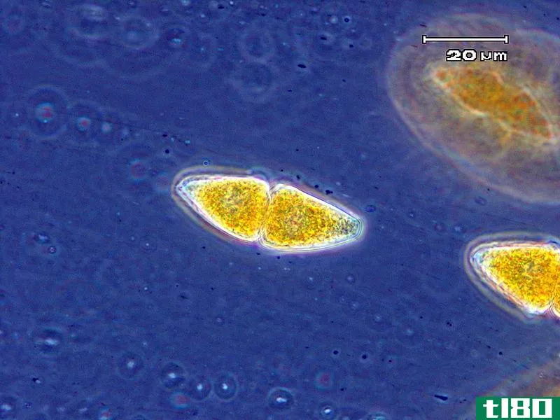 脲孢子(uredospore)和柄孔(teliospore)的区别