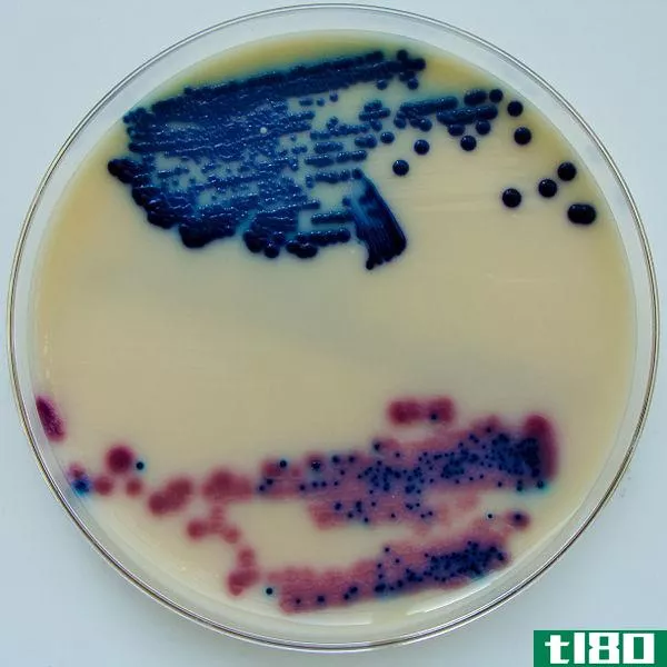 尿检(urinalysis)和尿培养(urine culture)的区别