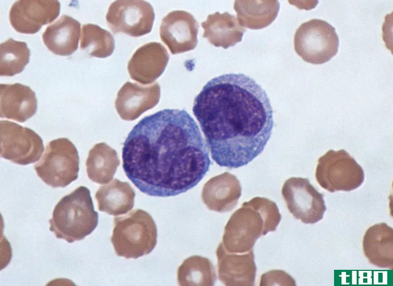 单核细胞(monocyte)和巨噬细胞(macrophage)的区别