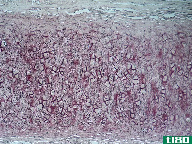 成软骨细胞(chondroblasts)和软骨细胞(chondrocytes)的区别