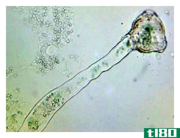 生殖核(generative nucleus)和花粉管核(pollen tube nucleus)的区别