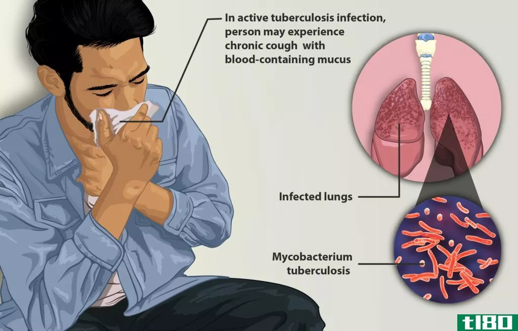 结核分枝杆菌(mycobacterium tuberculosis)和非结核分枝杆菌(nontuberculous mycobacteria)的区别