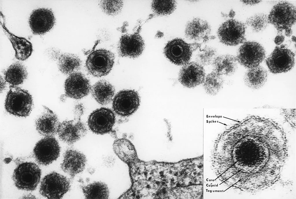 麻疹(measles)和玫瑰疹(roseola)的区别