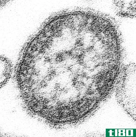 正粘病毒(orthomyxovirus)和副粘病毒(paramyxovirus)的区别