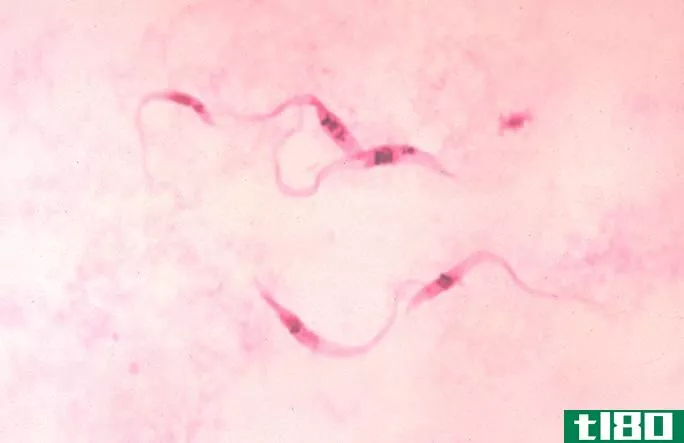 克鲁兹锥虫(trypanosoma cruzi)和兰氏锥虫(trypanosoma rangeli)的区别