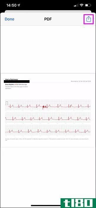 如何与医生分享apple watch的心电图