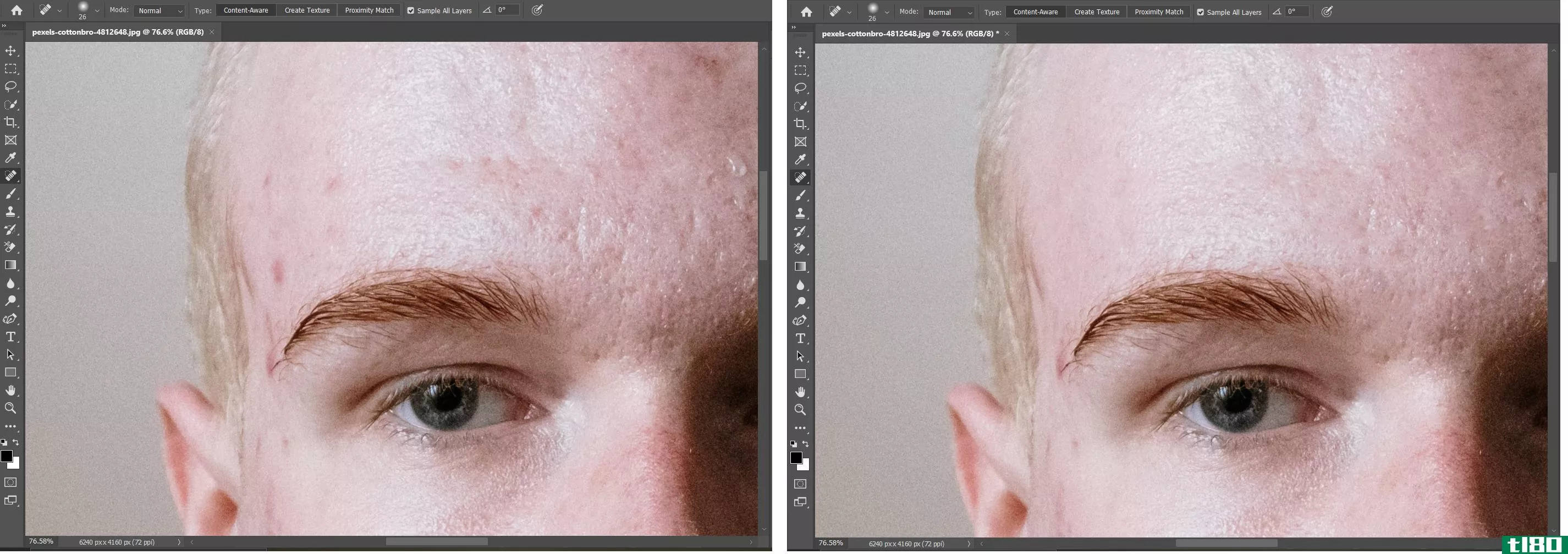 Photoshop screens of a man with and without spots