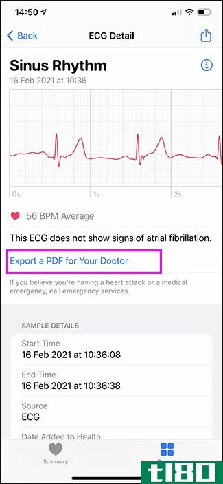 如何与医生分享apple watch的心电图