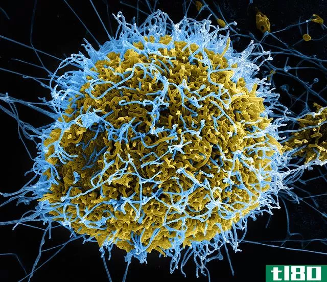 一种实验性的埃博拉疗法可以在感染者身上进行测试