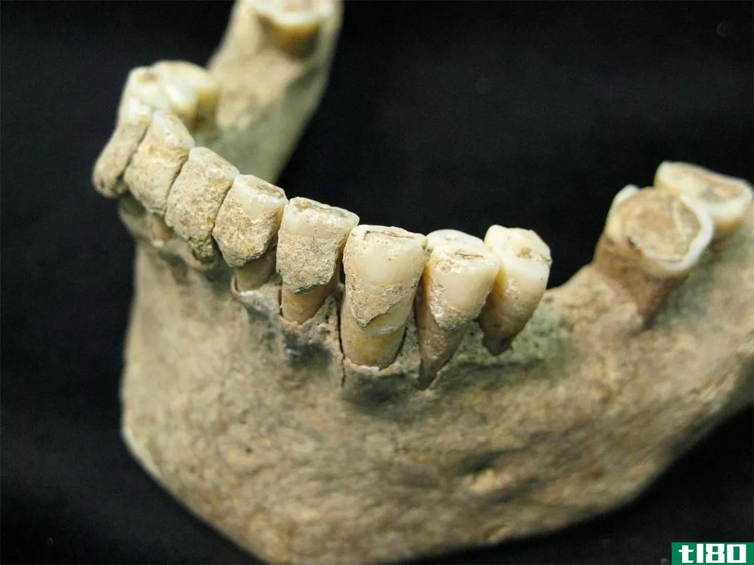 你的牙菌斑可以揭示你的饮食习惯，死亡几百年后的疾病