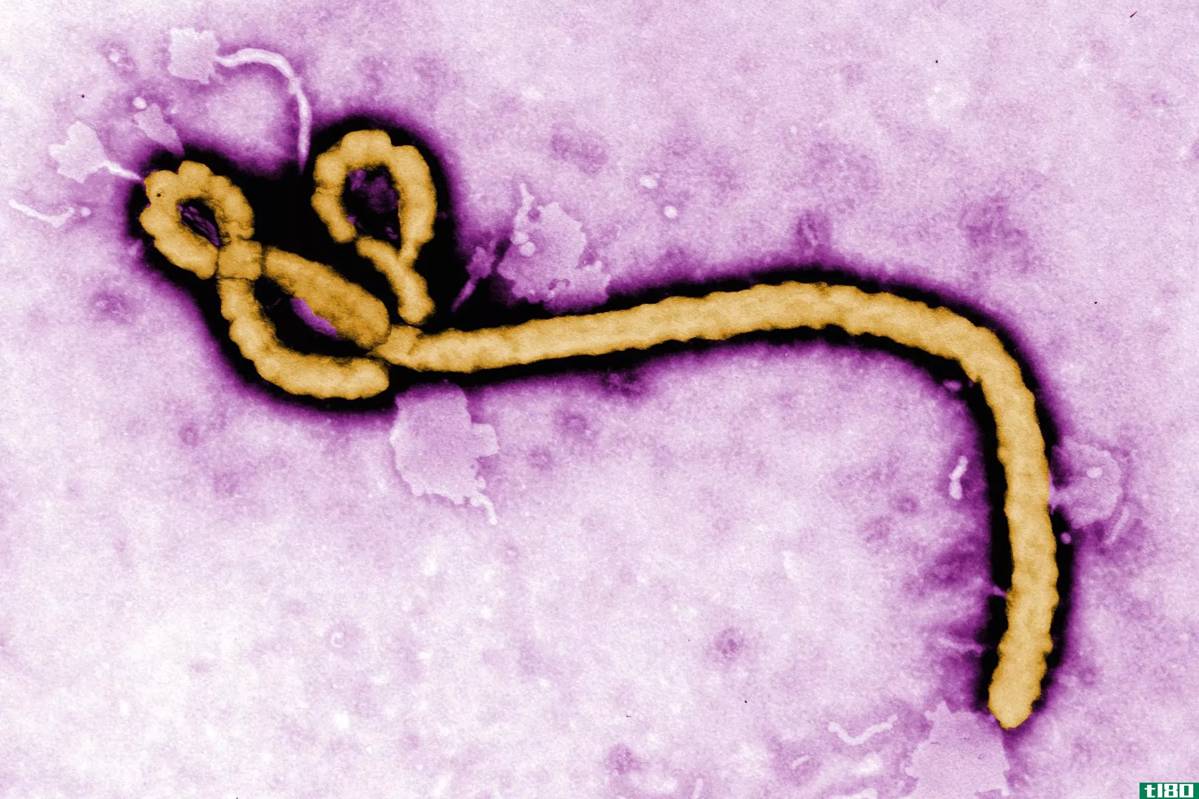 fda批准埃博拉病毒的首次治疗