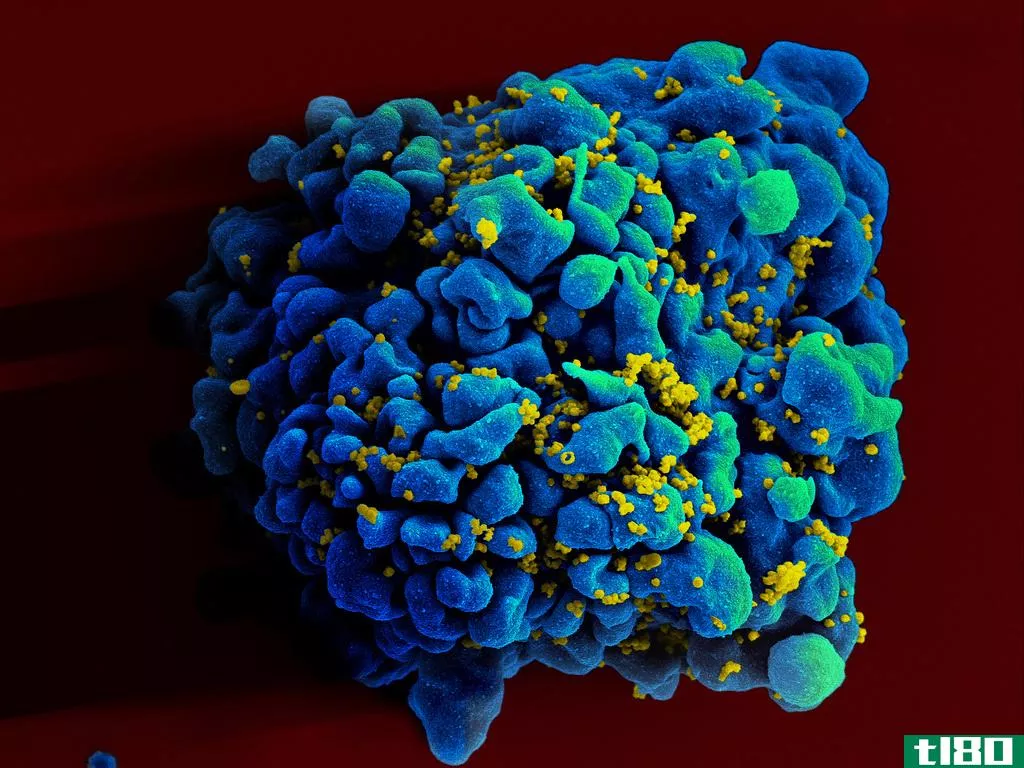 一剂新的hiv药物能使病毒减弱28天
