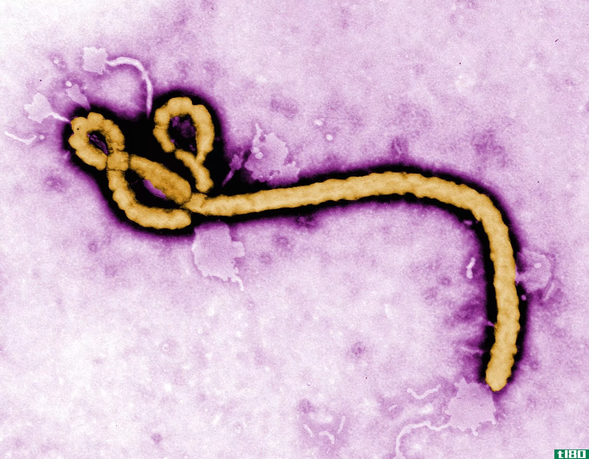 世界卫生组织批准埃博拉病毒15分钟快速检测
