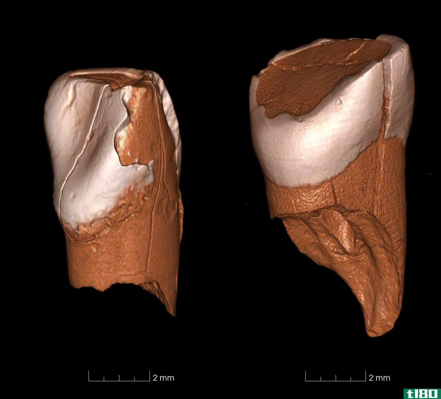 4万年前的牙齿表明古代文化属于人类，而不是尼安德特人
