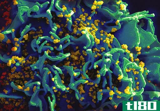 实验性的新的hiv治疗可以预防感染