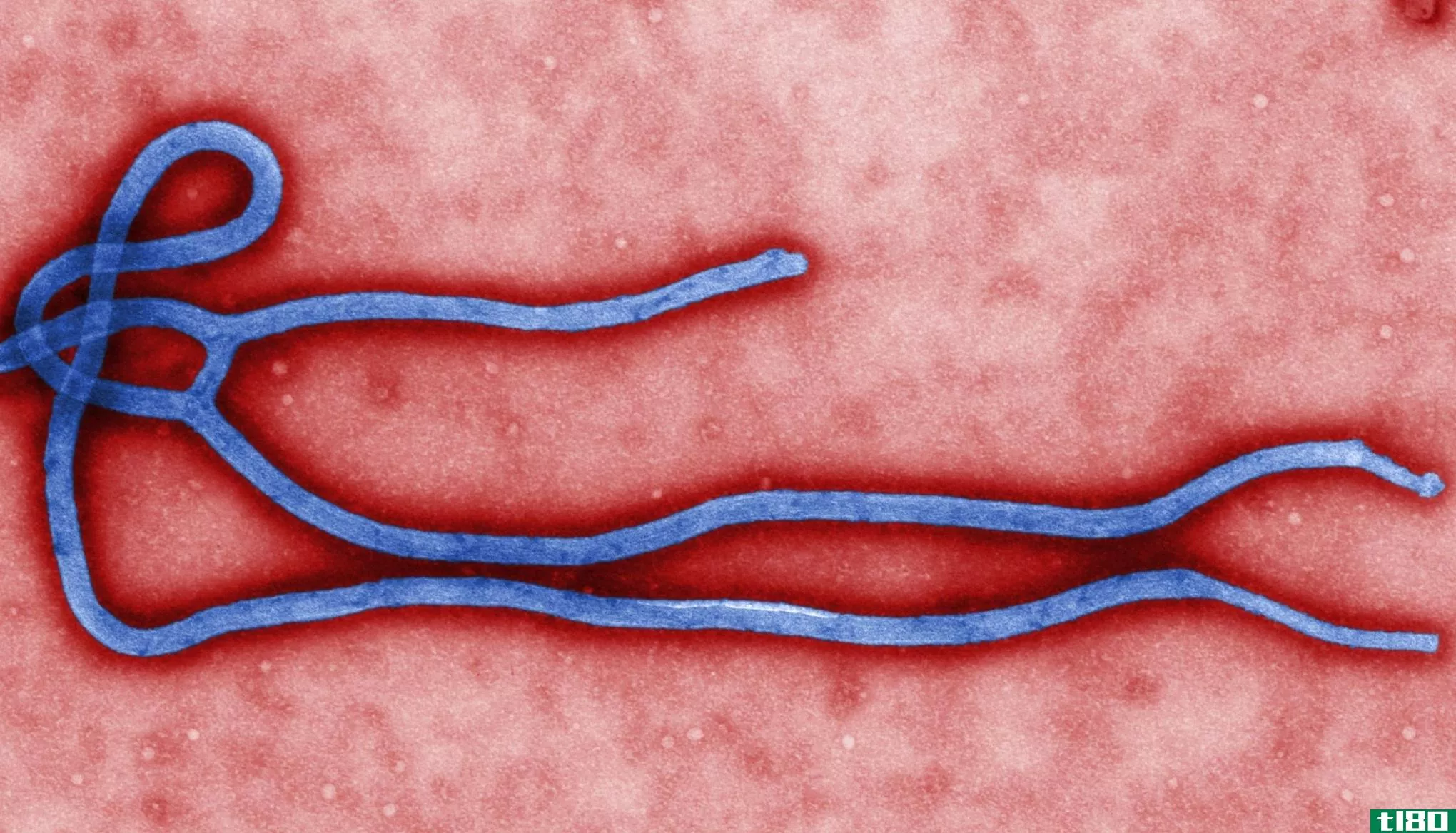有希望的实验性埃博拉药物被发现无效